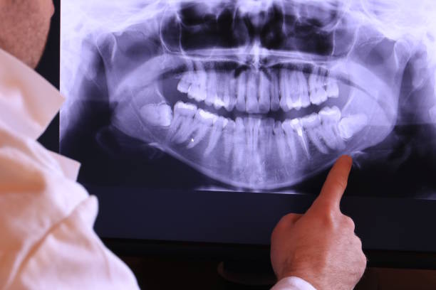 Best Emergency Treatment for Dental Infections or Abscesses in Lakewood Ranch, FL